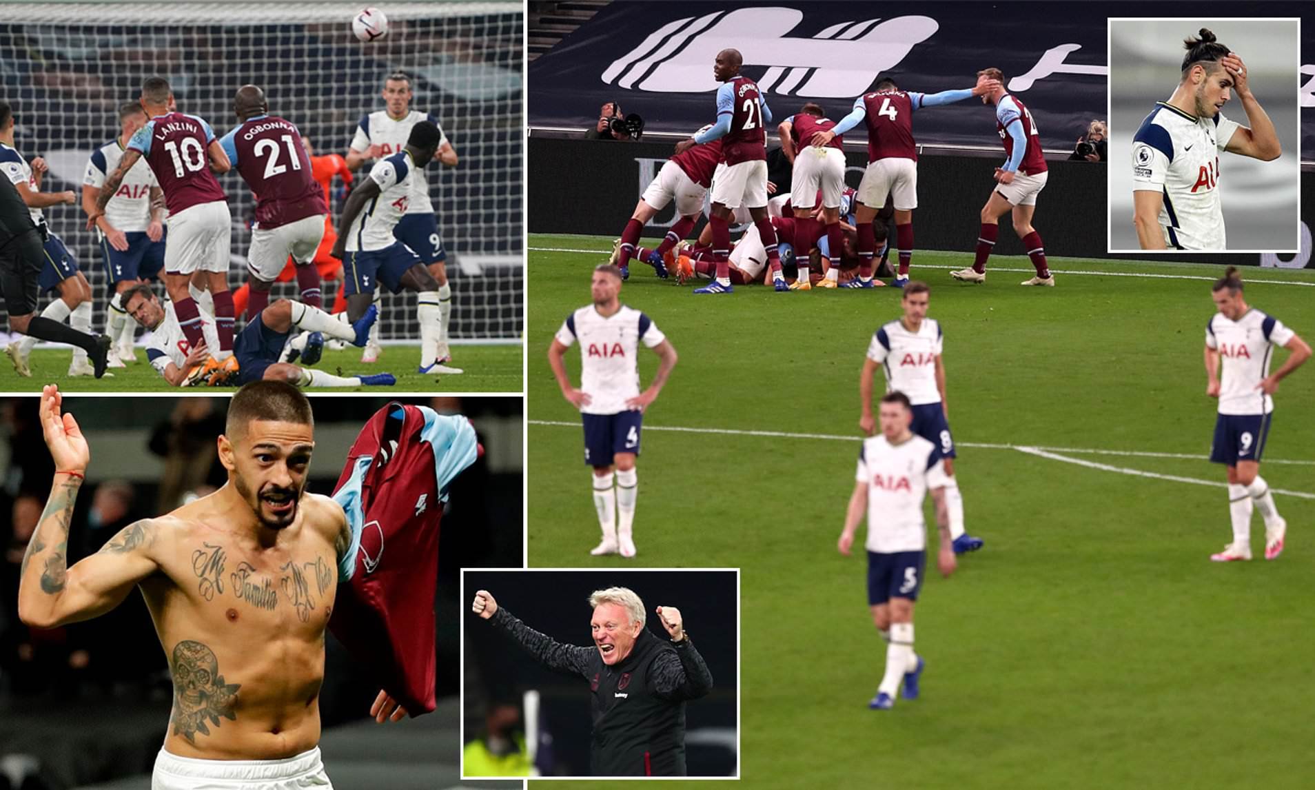 布莱顿门将 布莱顿门将